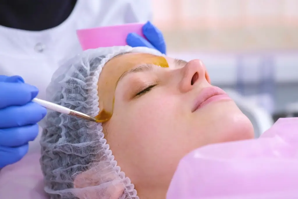 Chemical Peels in The Woodlands, TX